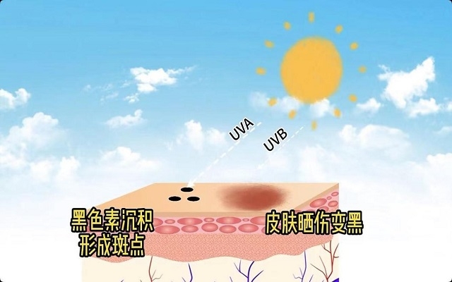 天然蝦青素可以祛斑嗎？